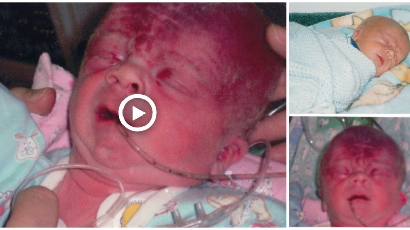 The baby’s miraculous resurgence is said to have stopped breathing for several times