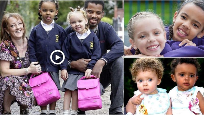 Girls Born with Contrasting Skin Tones Forge Separate Paths in Life