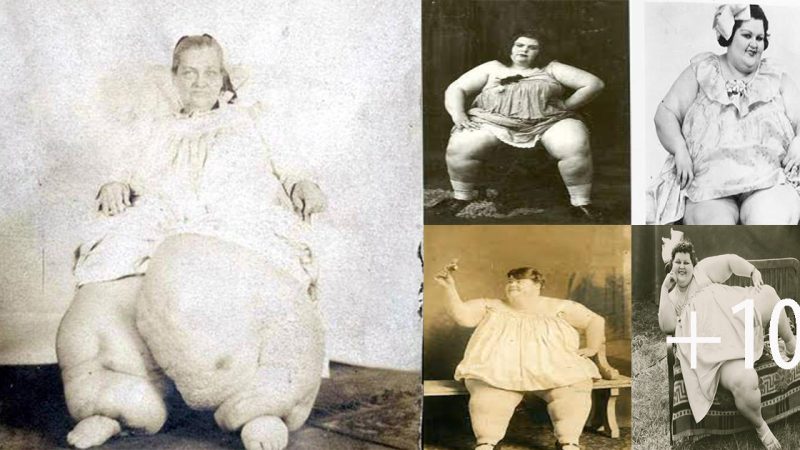 freaks of the past barnorama. The Large-Legged Lady