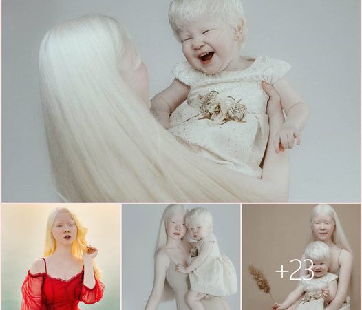 Two Sisters Overcoming a 12-Year Age Gap and Albinism to Conquer the Modeling World