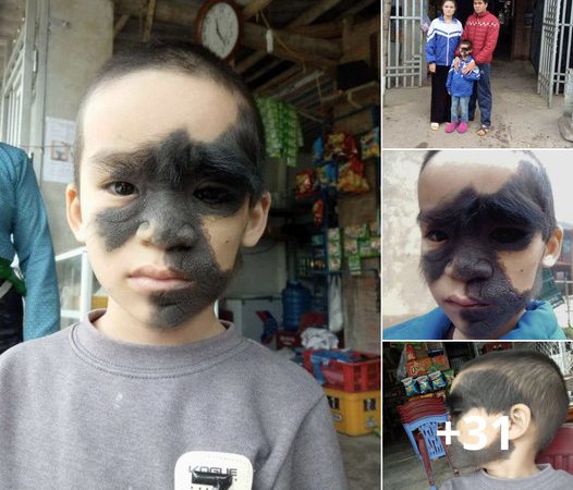 Hopeful Aspirations of the Monkey-Faced Boy: A Wish for Future Transformation