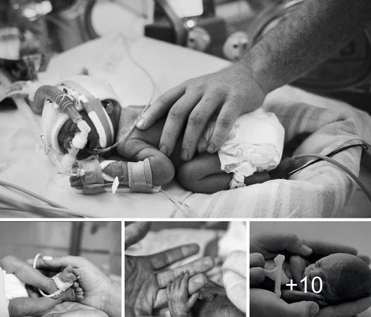 The Remarkable Path of Premature Infants: Fragile Starts yet Resilient Determination