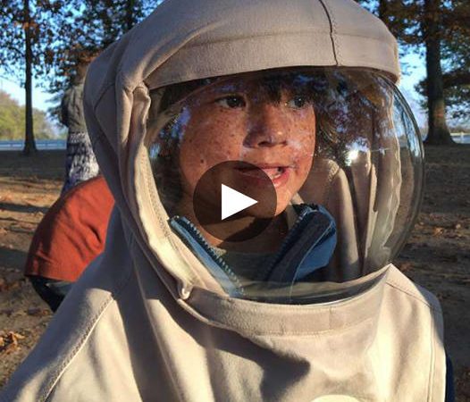 A Remarkable Journey: The Extraordinary Moon Boy Battling a Rare Sun Allergy and Skin Cancer Risk