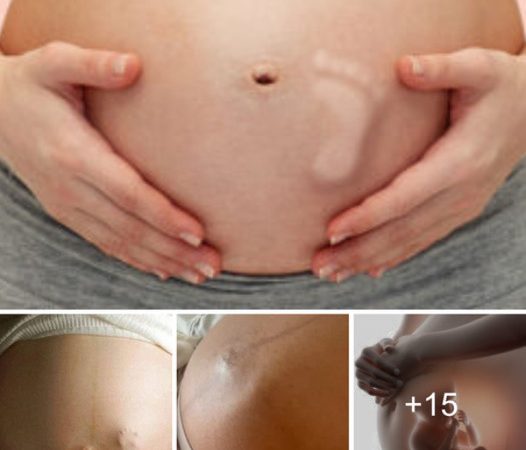 People are amazed as a pregnant woman witnesses her baby’s ‘foot’ in motion