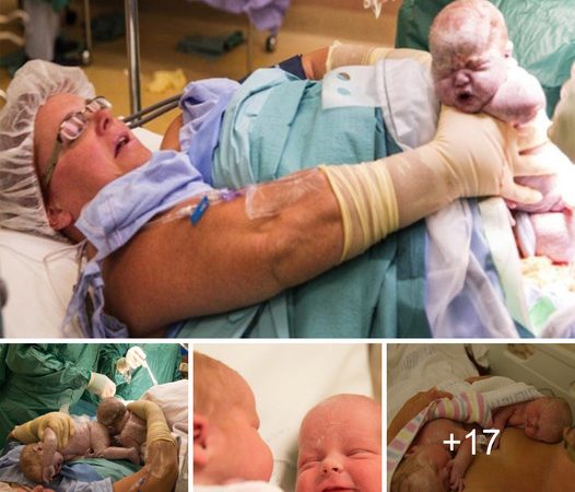 Unbelievable Double Miracle: Mother’s Extraordinary C-Section Delivery of Twins