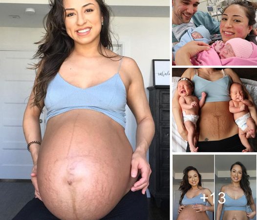 Viral Sensation: Unbelievable Pregnancy Photos of Twins’ Before and After Bellies