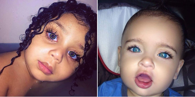 Charming Twin Babies with Unique Eyes Steal Hearts with Their Dark Skin