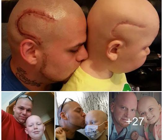 A Father’s Unwavering Love: Matching Head Tattoo to Support Son’s Battle Against Brain Cancer