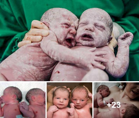 The Magical Bond of Twins: From Womb to World