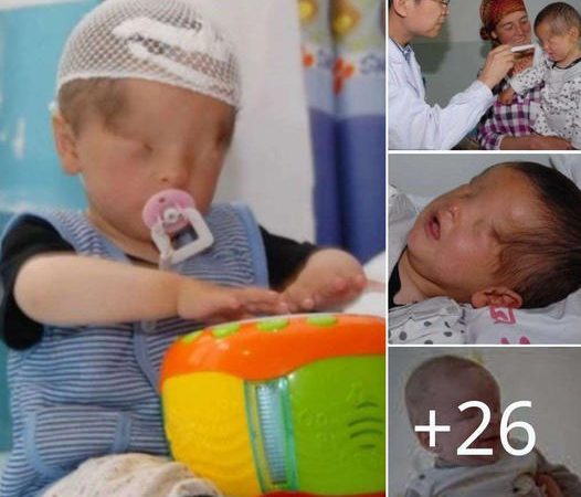 The Extraordinary Story of Sasha: A Baby Born Without Eyes