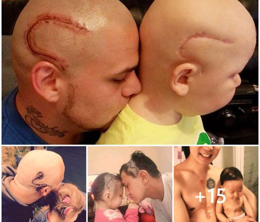 A Father’s Profound Act: Tattooing His Scars to Support His Ailing Child