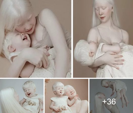 Mesmerizing Charisma: The Timeless Allure of Two Albino Sisters (Video)