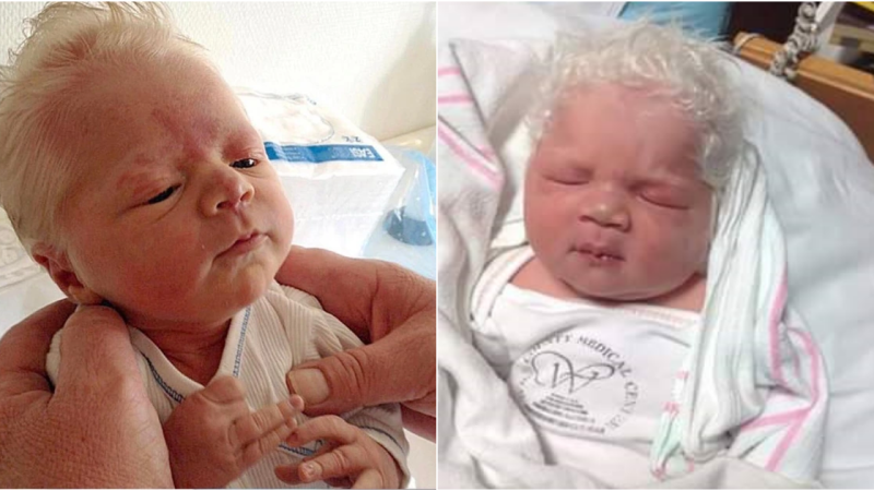 The Enchanting Tale of Bence: The Newborn with White Hair, Dubbed ‘White Horse Prince