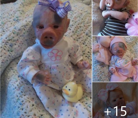 A Remarkable Birth: The Enigma of a Baby with a Pig-Like Face